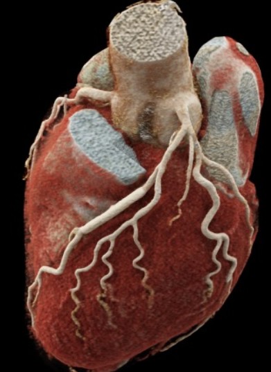 3D Rendered Heart Scan DICOM
